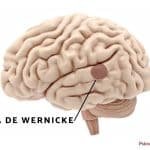 Afasia De Wernicke: Qué Es, Síntomas, Causas Y Tratamiento.