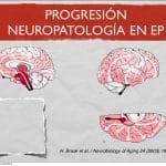 Neuropsicología De La Enfermedad De Parkinson.