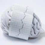 Qué Es La Epilepsia Refractaria: Síntomas, Causas Y Tratamiento.