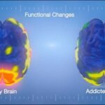 El Cerebro Adicto: Anatomía De La Compulsión Y La Necesidad